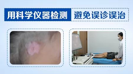 孩子脸上刚长了块小白斑也有可能是白癜风吗