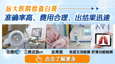怎么区分白癜风和日光性白斑