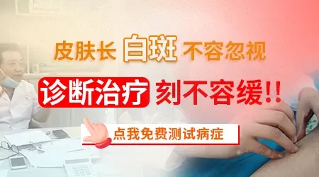 早期白癜风有什么明显症状与其他白斑不同