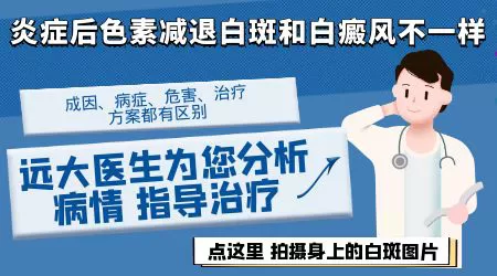 白癜风和炎症后色素减退怎么区分