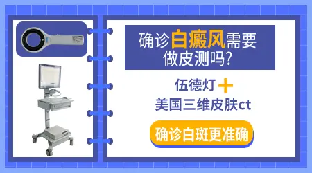 如何判断白斑是不是白癜风区分图片