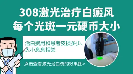 308准分子激光治疗白癜风一个光斑多少钱