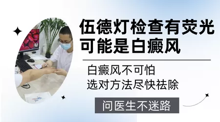 wood灯下白斑显示亮白色病情分析