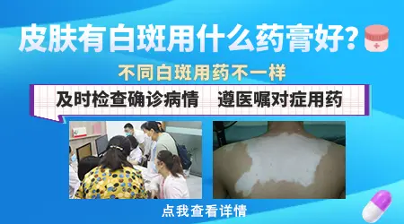 皮肤黑色素缺失用什么药膏效果好