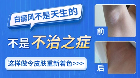 宝宝腿上出现白斑越来越大怎么回事