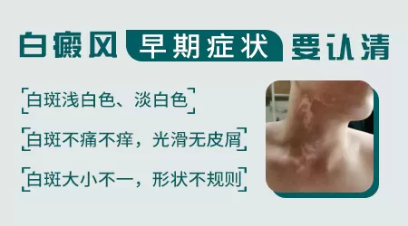 白癜风早期症状是什么样子的