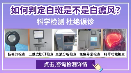 白癜风早期症状是什么样子的