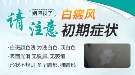 白癜风早期有什么明显征兆图片