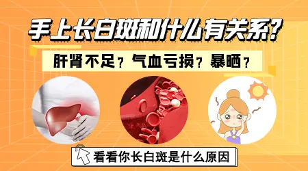 手部白癜风有什么好的法子治好