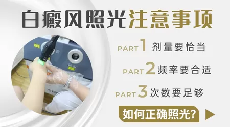 308激光治好白癜风的病例多不多