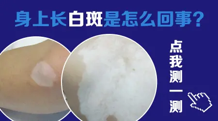 胳膊上长小白点晒完太阳更明显了怎么回事