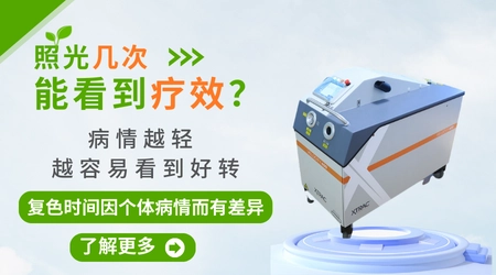 白癜风光疗仪器家用和去医院照效果差很多吗