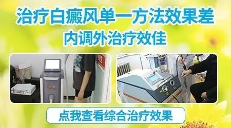 不同部位的白癜风用药有区别吗