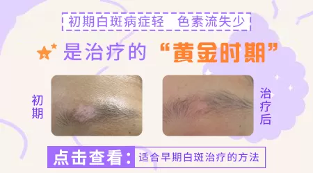 身上皮肤出现白癜风早期图片