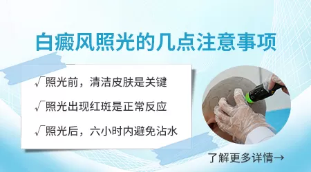 308激光照白斑后有轻微灼热感是剂量过大吗