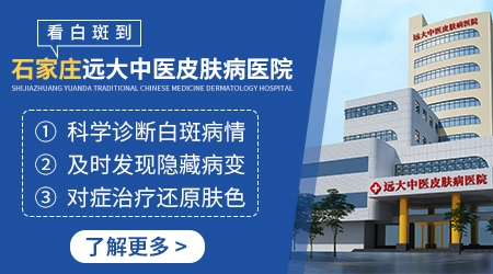 小孩脸上有白斑需要挂什么科