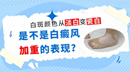 不同颜色的白癜风白斑治疗难度有区别吗