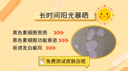 青少年长白斑和军训暴晒有关系吗