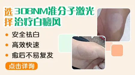 哺乳期白斑扩散厉害该怎么安全控制