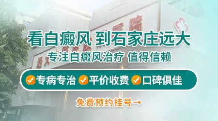 石家庄哪个医院的皮肤科看白斑口碑好