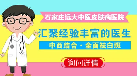 皮肤白斑在石家庄找哪个医生看更靠谱