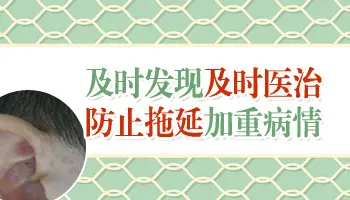 早期白癜风不明显时的症状图片