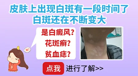 身上的小白点慢慢变大了是怎么回事