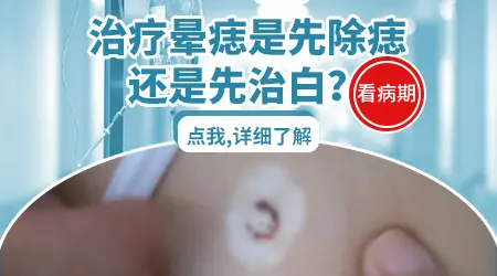 晕痣白癜风用不用把痣切掉