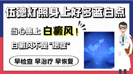 伍德灯下可见浅蓝白色斑点边界清晰是什么问题