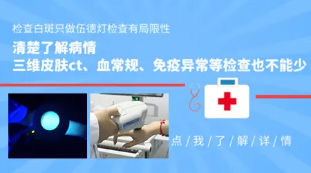 伍德灯下可见浅蓝白色斑点边界清晰是什么问题
