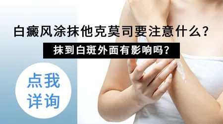 儿童白斑长在眼皮上涂他克莫司会不会刺激眼睛