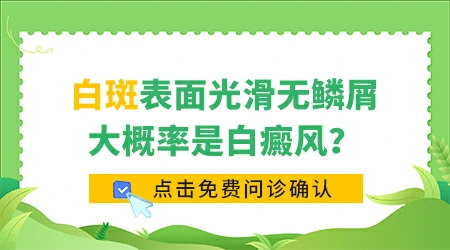 白斑不疼不痒光滑就是白癜风吗
