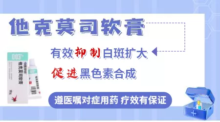 早期白癜风只涂他克莫司能好吗