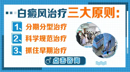 白癜风早期有没有可以根治的方法