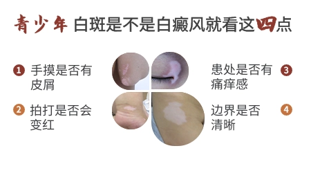 12岁女孩脸上长发亮的白点是怎么回事