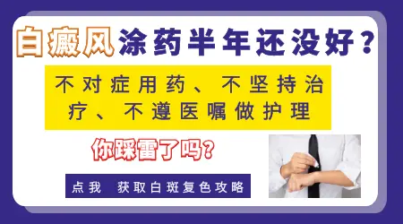 白癜风吃药抹药输液都不管用怎么办