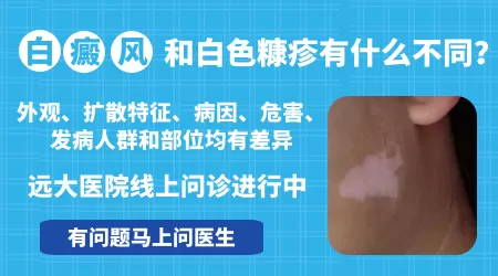 面部白色糠疹和白癜风对照图片