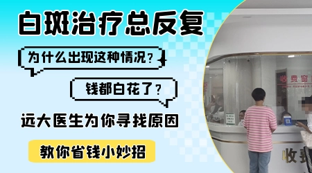 晕痣型白癜风复发的概率高不高