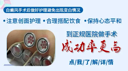 白癜风做植皮手术一次成功的概率有多少