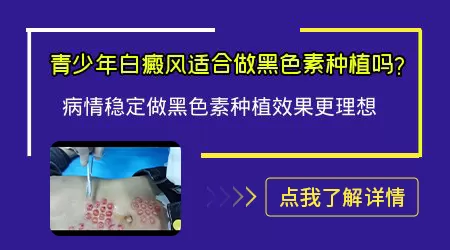 白癜风做植皮手术一次成功的概率有多少