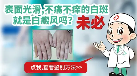 白斑不痛不痒光滑是不是一定是白癜风