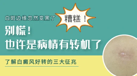 伍德灯显示白斑周围有一圈深色的边是什么意思