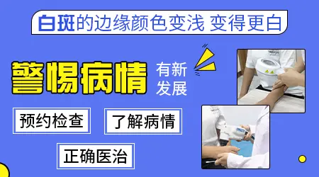 额头皮肤有块白越来越明显怎么回事