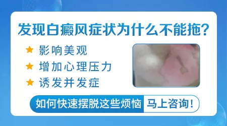 白癜风和其他白斑初期症状区别图片