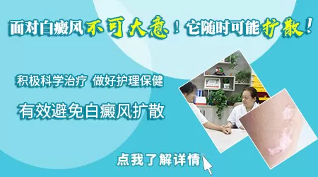 身上的白斑不痛不痒也不扩散是不是就不用管