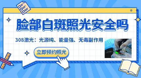 脸上晕痣型白癜风好治疗吗