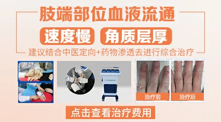 手指白癜风照308激光多次没好转还用继续吗