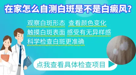 怎么判断白斑是不是白癜风？在家可以做的3个自测