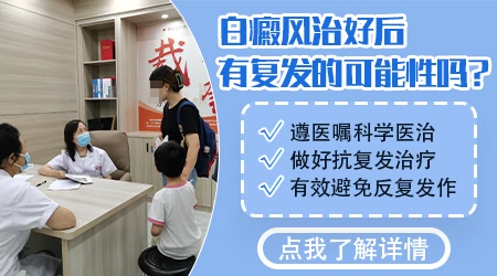 白癜风治好后复发率有多高