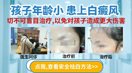 孩子脖子上长了块浅粉色的斑不痛不痒会不会是白癜风